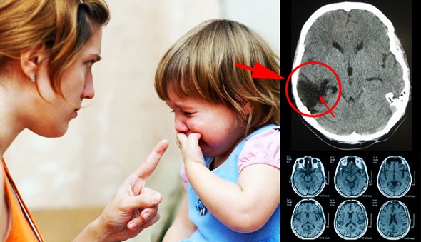 Sekali Tengking Jutaan Sel Otak Rosak, 7 Bahaya Tengking Anak Ibu Bapa Patut Tahu