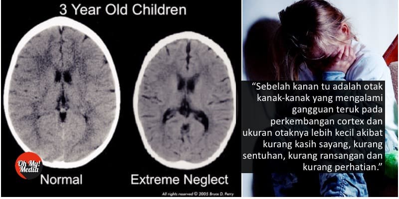 Dasyatnya Kesan Pada Otak Jika Anak Selalu Diabaikan