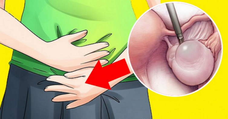 6 Warning Signs Of Ovarian Cyst That No Woman Should Ignore