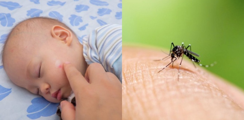 Baby Bengkak Kemerahan Digigit Nyamuk